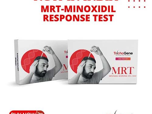 Know The Benefits Of Trichogene- MRT (Minoxidil Response Test) For Hair  Loss Treatment